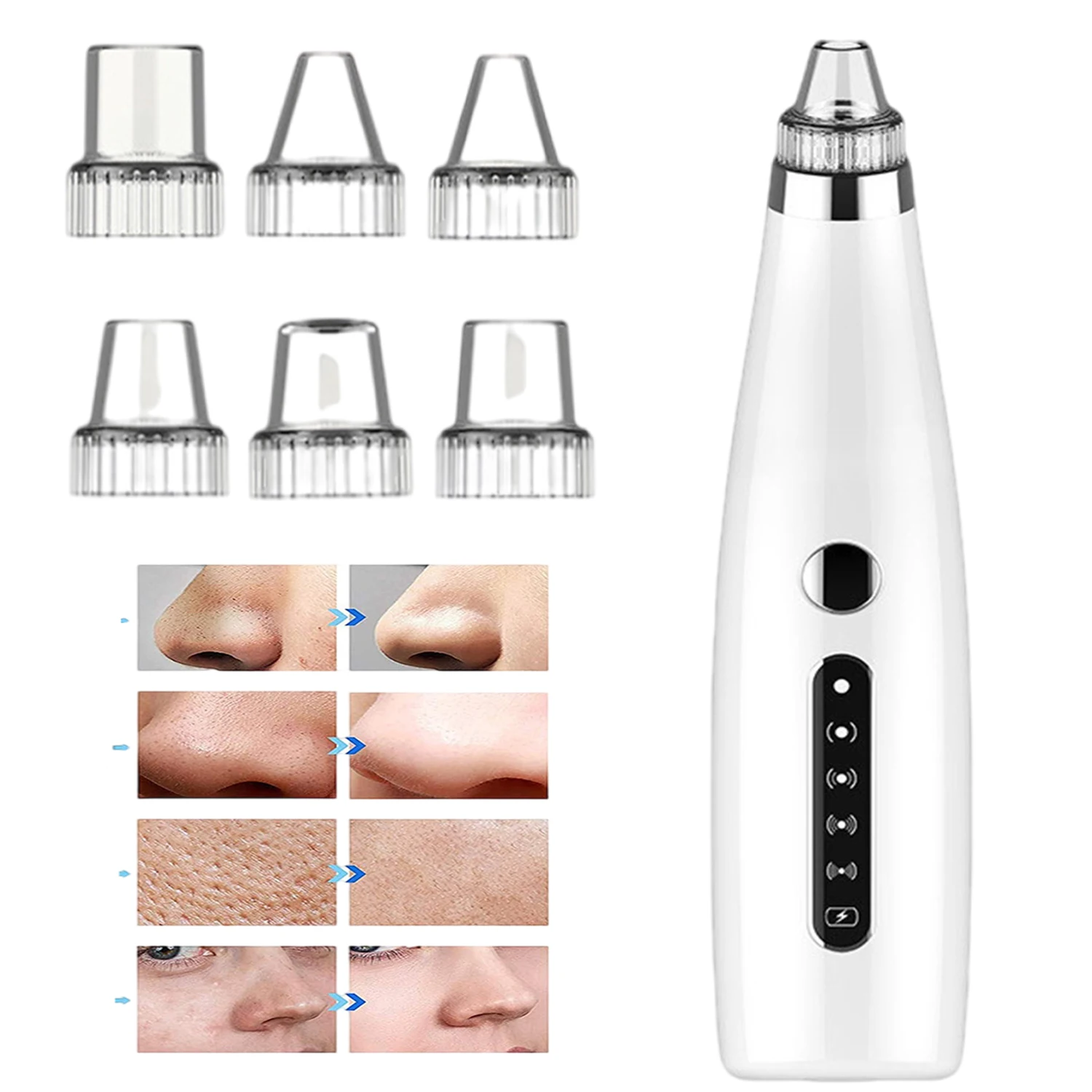 

Blackhead Remover,Electric Blemish Cleaner Vacuum Suction,Beauty Health Face Care Tool,Removal for Pore,Nose Acne,Pimple Tag