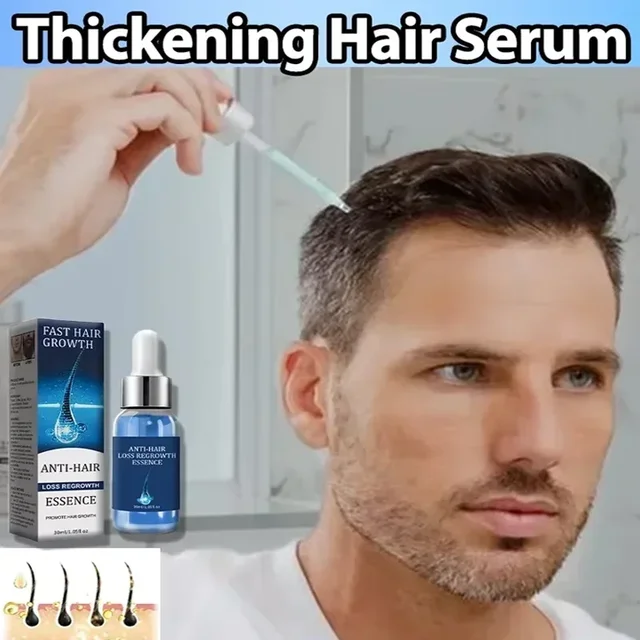 Treatment of hereditary seborrheic alopecia with hair growth essence oil