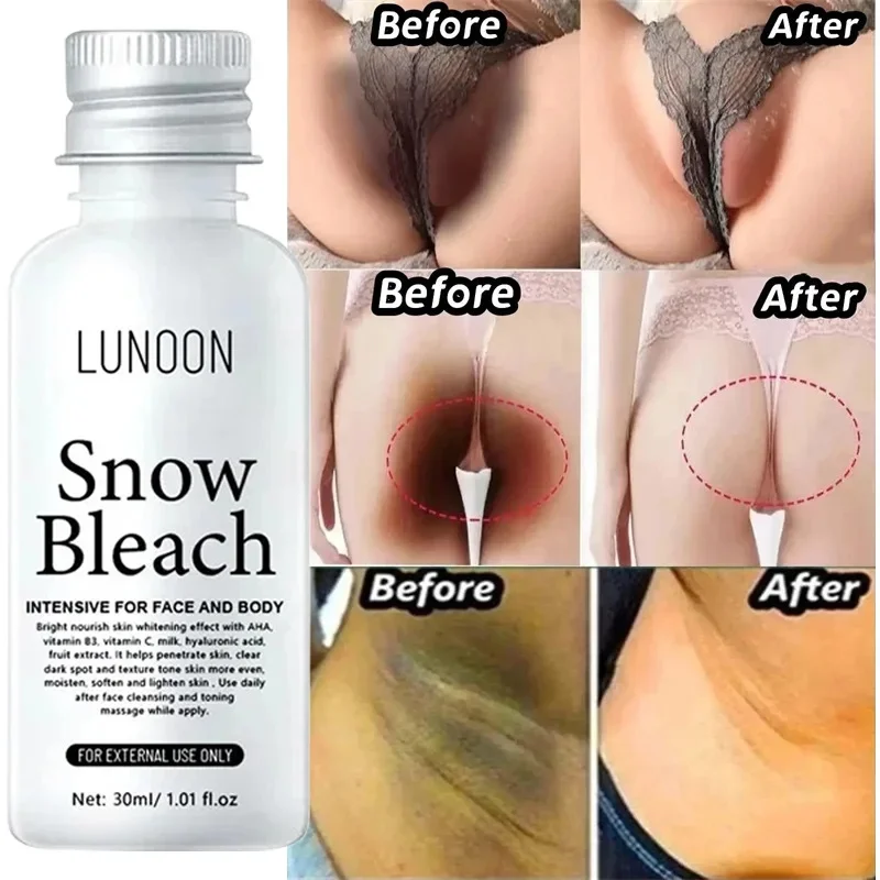Whitening Cream Private Parts Underarm Bleaching Serum Whiten Butt Knee Brighten Inner Thigh Intimate Parts Dark Remove Melanin whitening cream whitening body cream brightening body cream brightening cream whitening serum
