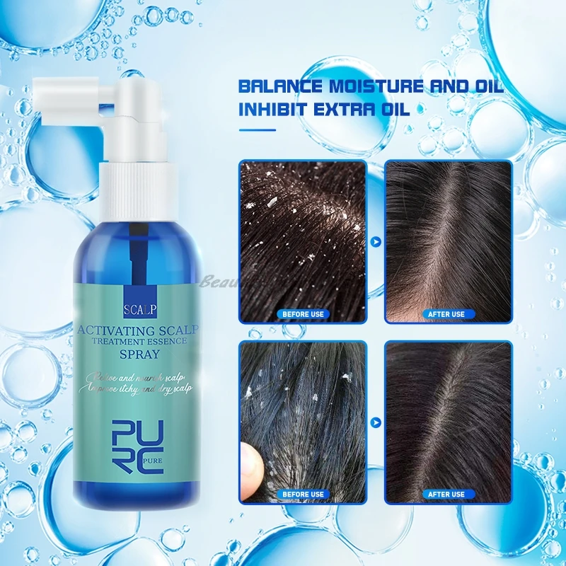 PURC Hair Scalp Treatment Anti Dandruff Itch Essence Spray Prevent Hair Loss Oil Control Hair Care For Men Women