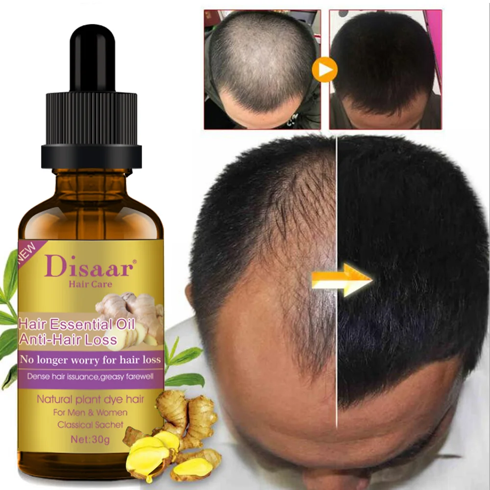 Ginger Hair Growth Products Beauty Hair Care Prevent Hair Loss Oil Scalp Treatment For Men Women Hair Essential Oil