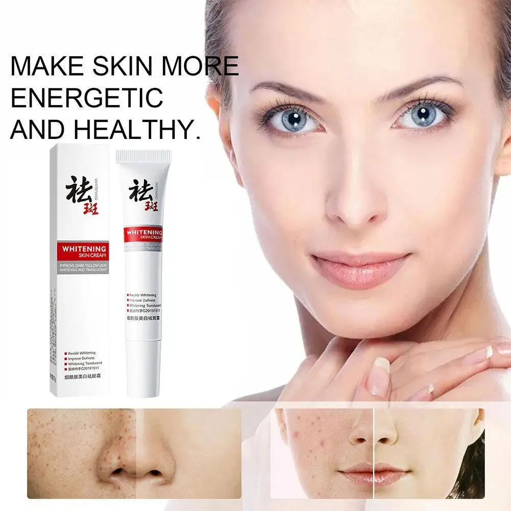 

Effective Whitening Freckle Cream Remove Dark Spot Face Brighten Melasma Smooth Lighten Removal Skin Care Cream K3E7
