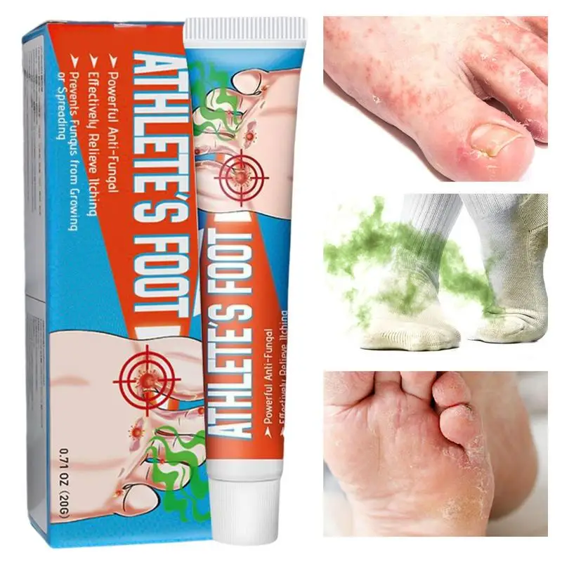 

20g New Anti Athlete's Foot Cream Onychomycosis Paronychia Toe Nail Cream Repair Feet Care