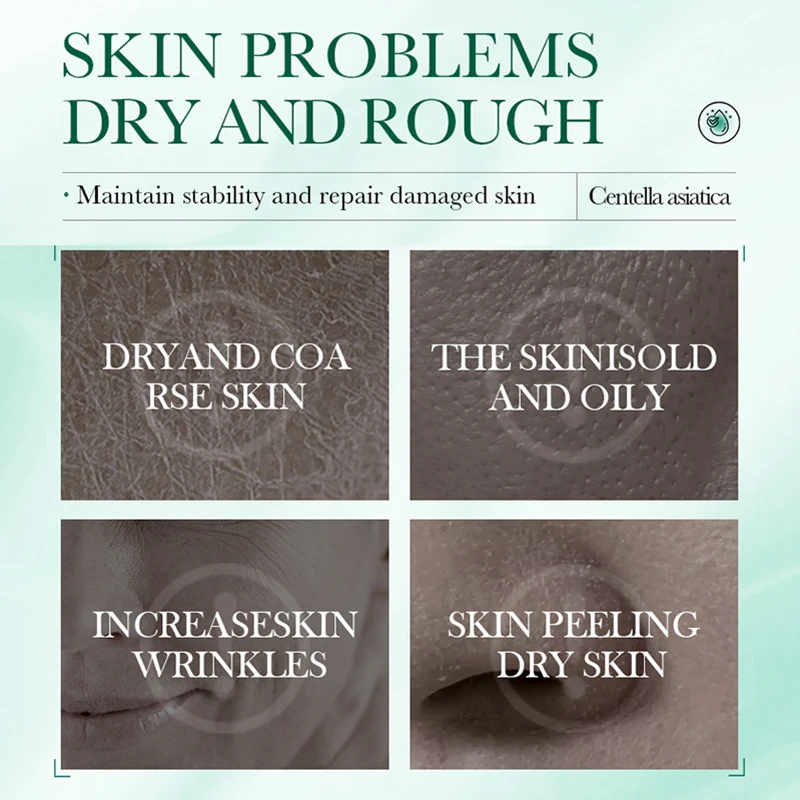 100ml SADOER Centella Hyaluronic Acid Facial Serum Face Firming Hydrating Essence Skin Care