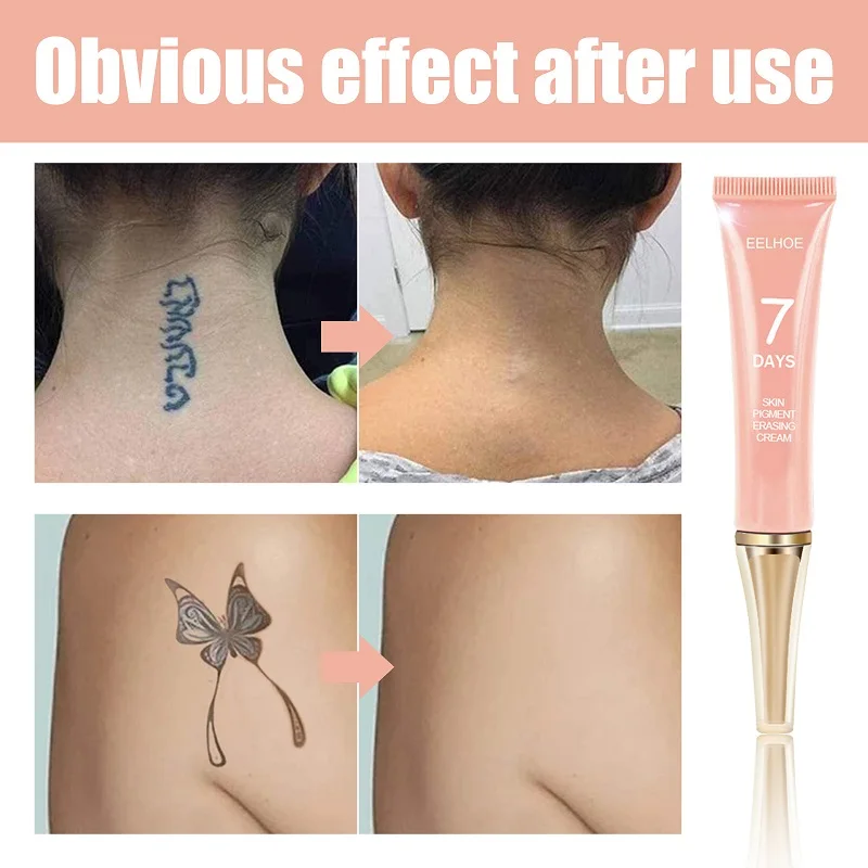 7 Days Permanent Tattoo Removal Cream Moisturize Skin Tattoos Remover Gel No Pain Removal Maximum Strength Body Tattoo Cleaning - Image 3