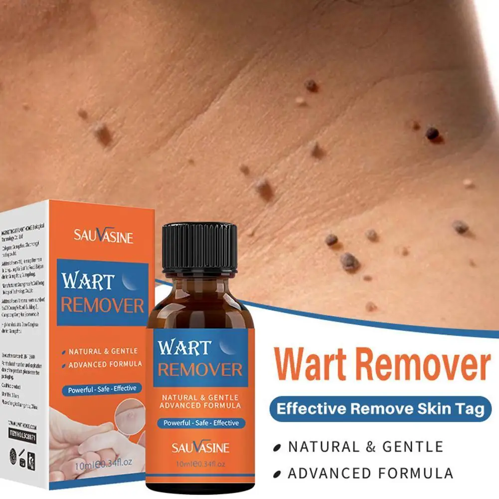 

10ml Wart Removal Liquid Skin Tag Remover Against Mole & Genital Treatment Papillomas Removal Of Warts Liquid From Skin Tags