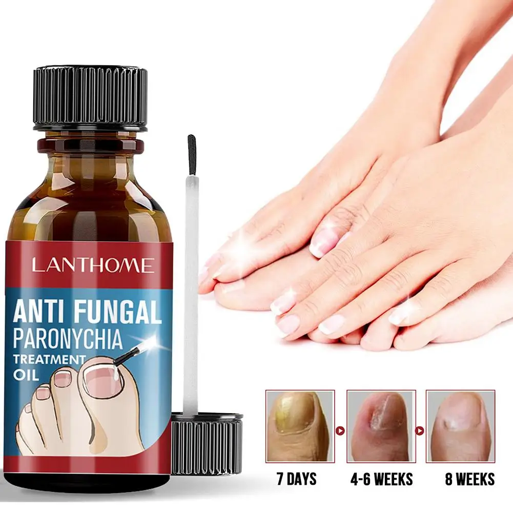 

10ml Effect Fungal Nail Treatment Oil Foot Repair Essence Anti Infection Gel Cream Nail Toe Fungal Nail Fungus Removal Remo Y3O3