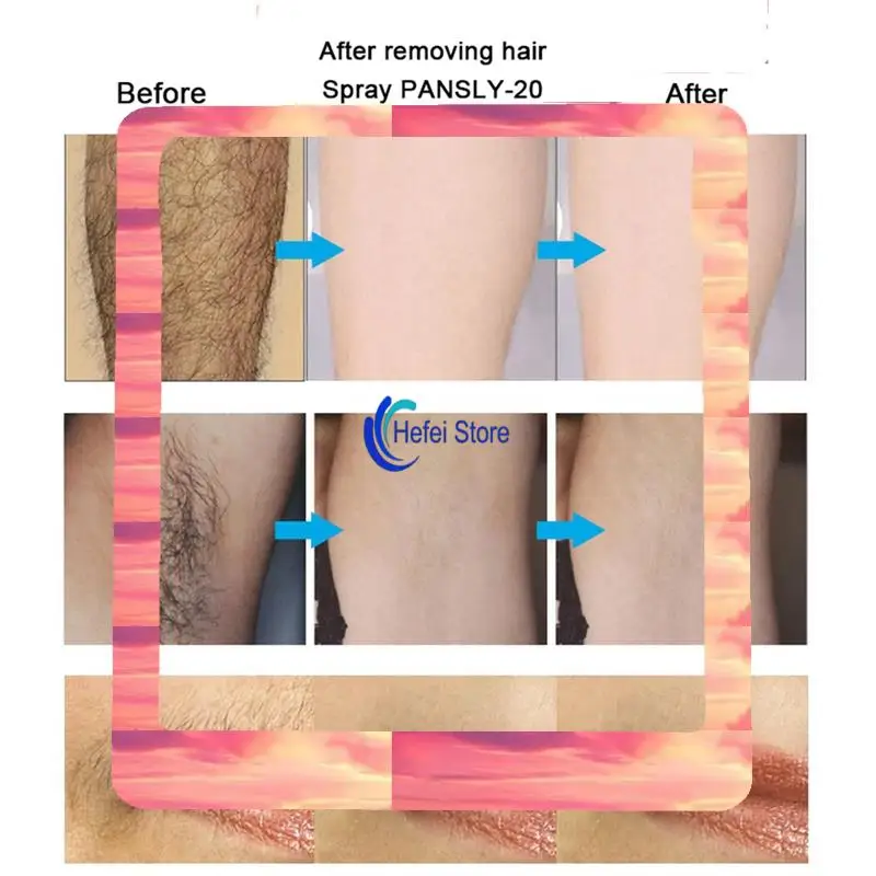 24-Hour Delivery 6X PANSLY Hair Growth Inhibitor Facial Removal Cream Spray Beard Bikini Intimate Face Legs Body Armpit Painless