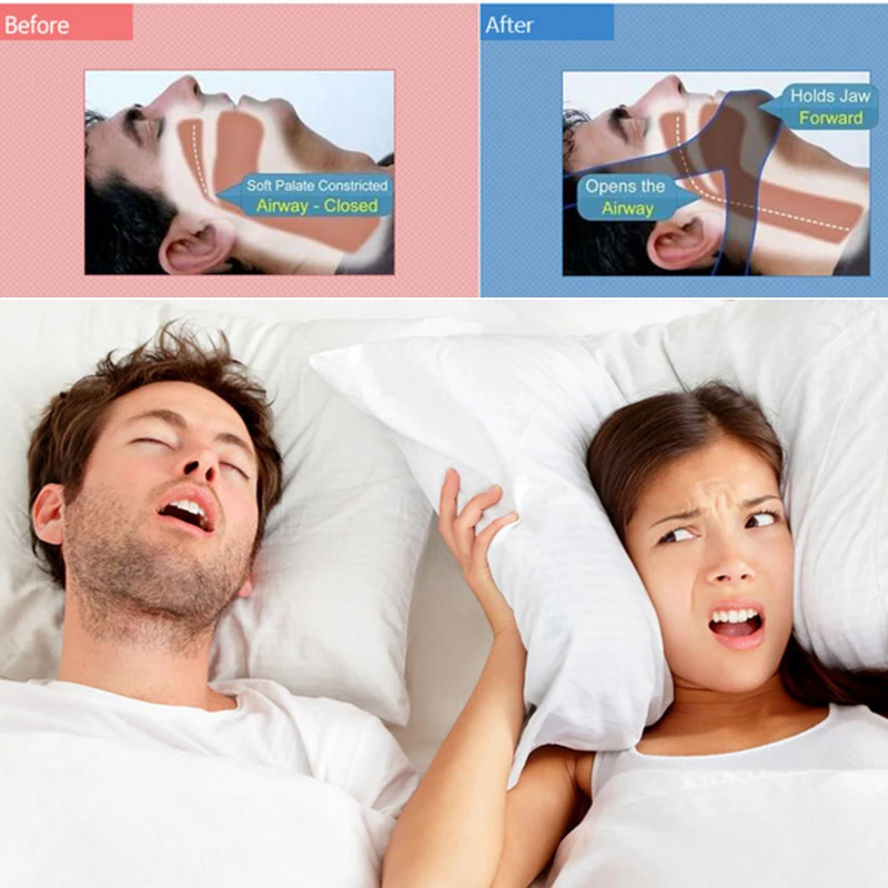 Anti Snoring Band 1PC CPAP Anti Snore Chin Strap Stop Snoring Sleeping Aid Adjustable Sleep Apnea Chin Support Straps Health Care