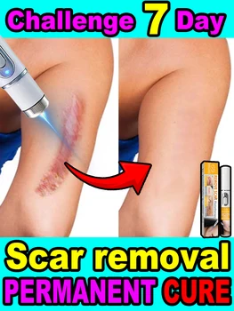 Nessun cicatrici, pelle liscia 1