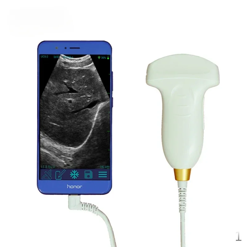 

128 Elements Wifi ultrasound USG / Wireless Ultrasound Probe For IOS Android Mobile Device