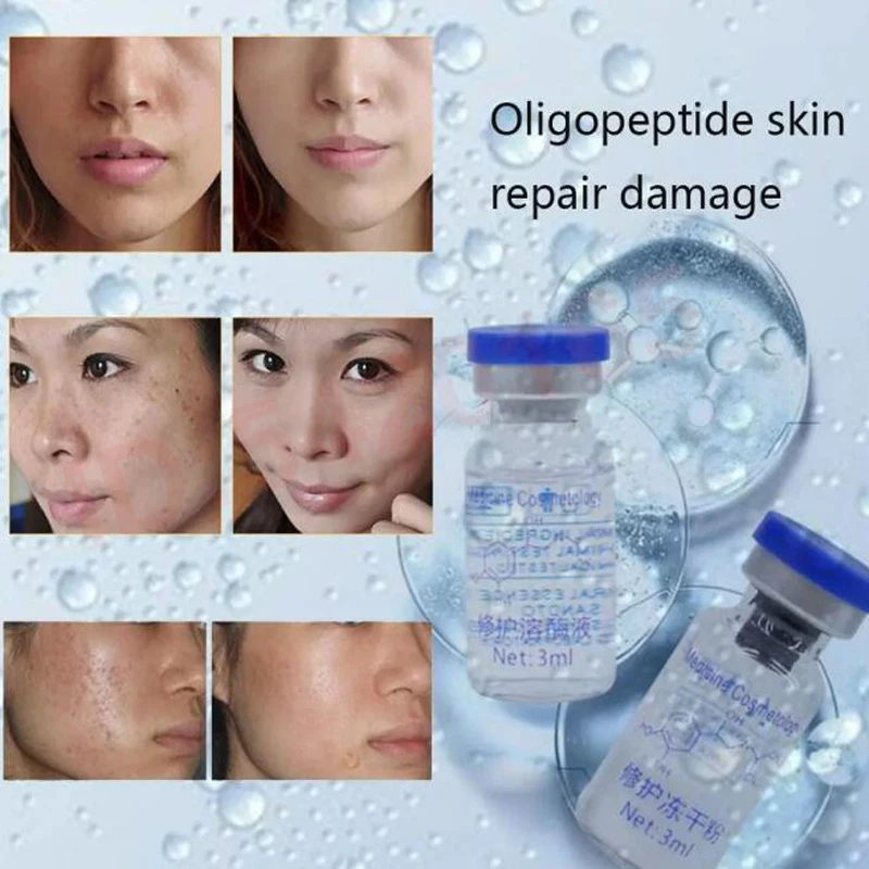 80000 Units EGF Serum Repairing Damaged Skin Acne Treatment Liquid Face Serum Skin Care Products Korean cosmetics 4