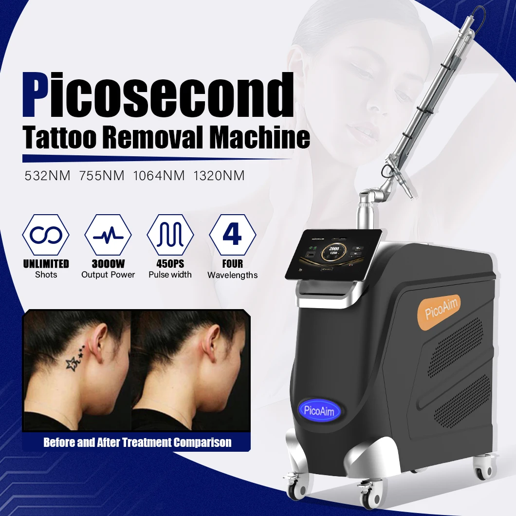 Новейшая машина для удаления татуировок Picosecond
