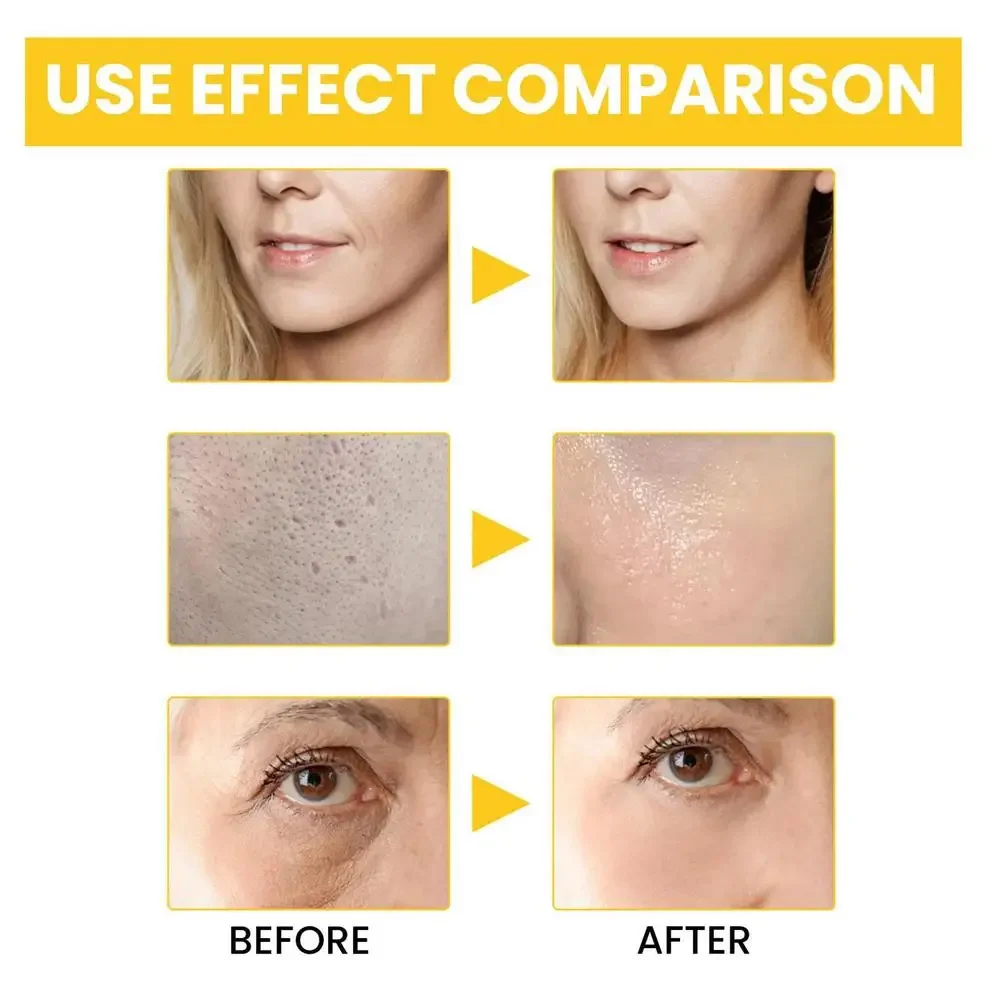 Retinol Anti Aging Remove Wrinkle Serum Lifting Brighten Face Skin Fade Eye Fine Lines Moisturizing Firming Facial Essence 30ml 4