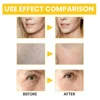 Retinol Anti Aging Remove Wrinkle Serum Lifting Brighten Face Skin Fade Eye Fine Lines Moisturizing Firming Facial Essence 30ml 4