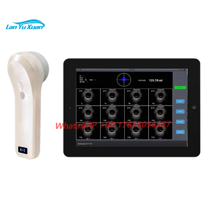 

Medical Equipment 80 Element 4D Wireless Probe Portable Ultrasound Bladder Scanner