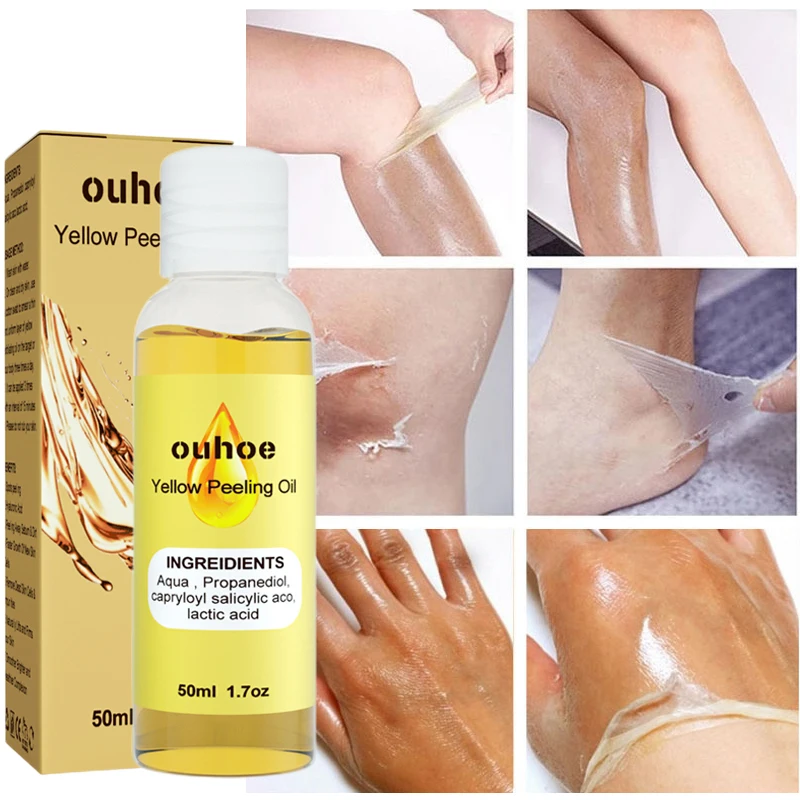 

Yellow Peeling Oil Dark Skin Bleaching Remove Arm Knee Legs Melanin Exfoliating Body Scrub Brighten Dead Skin Care Whiten Serum