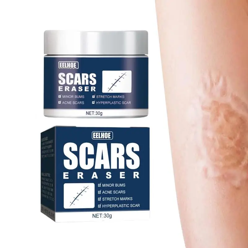 Scar Fade Cream Stretch Marks Removal Pimple Scars Skin Repair