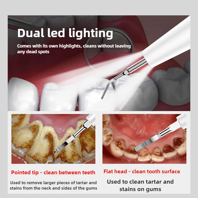 Ultrasonic Portable Electric Tooth Cleaner Dental Plaque Remover Home Personal Care Teeth Whitening Oral Cleaning Kit