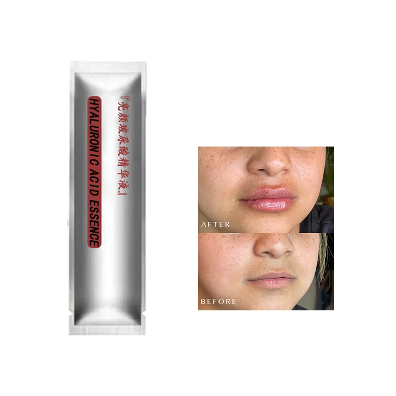 

New 20mg 2ml Lip Hyaluronic Acid Balm Lip Volume Plumper For Beauty Use