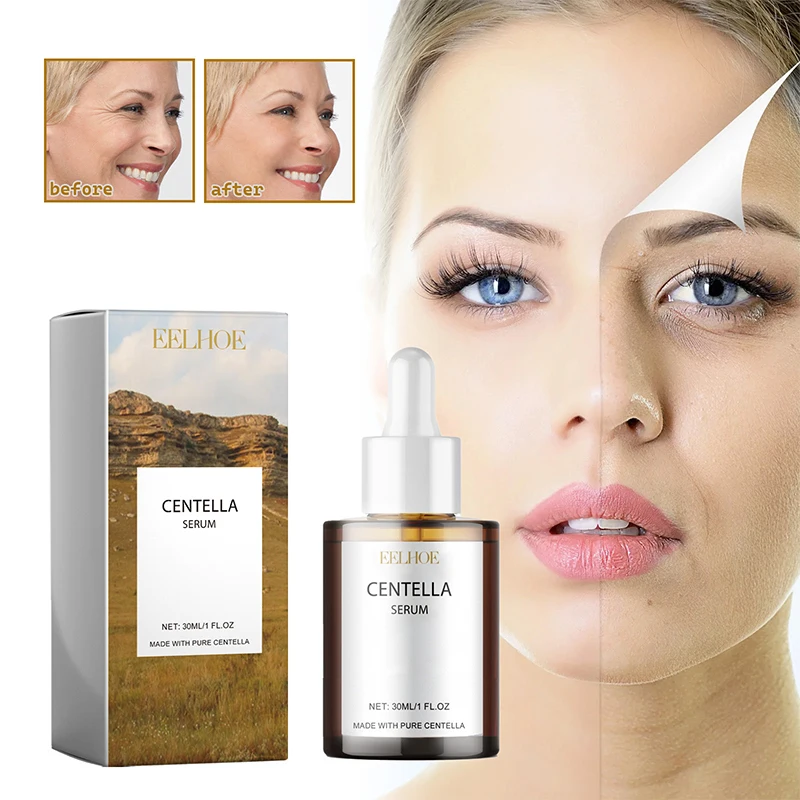 Centella Asiatica Soothing Calming Serum Retinol Facial Skin Firming Repairing Moisturizing Refreshing Ampoule Korean Skincare