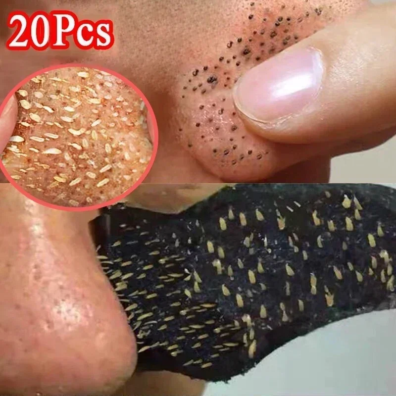 10-50PCS Nose Blackhead Remover Mask Shrink Pore Acne Treatment Sticker Black Dots Strips Nose Deep Cleansing Cleaner Skin Care 4