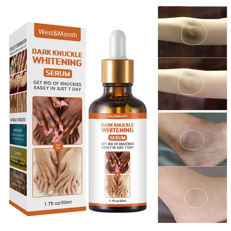 Joint Melanin Removal Serum Lighten Black Knee Ankle Brighten Skin Care Tone Body Armpit Whitening Rejuvenation Bleaching Cream dark knuckle whitening serum get rid of dark knuckles removal oil dark spots pigmentation correctors for black skin elbow knee