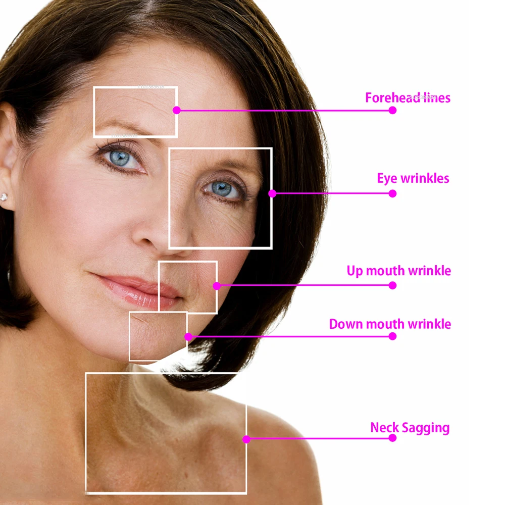 Mini Hifu Machine RF EMS PULSE LED 4-in-1 Skin Tightening Firming 3rd Fine Line Reduce Lifting Sagging Skin