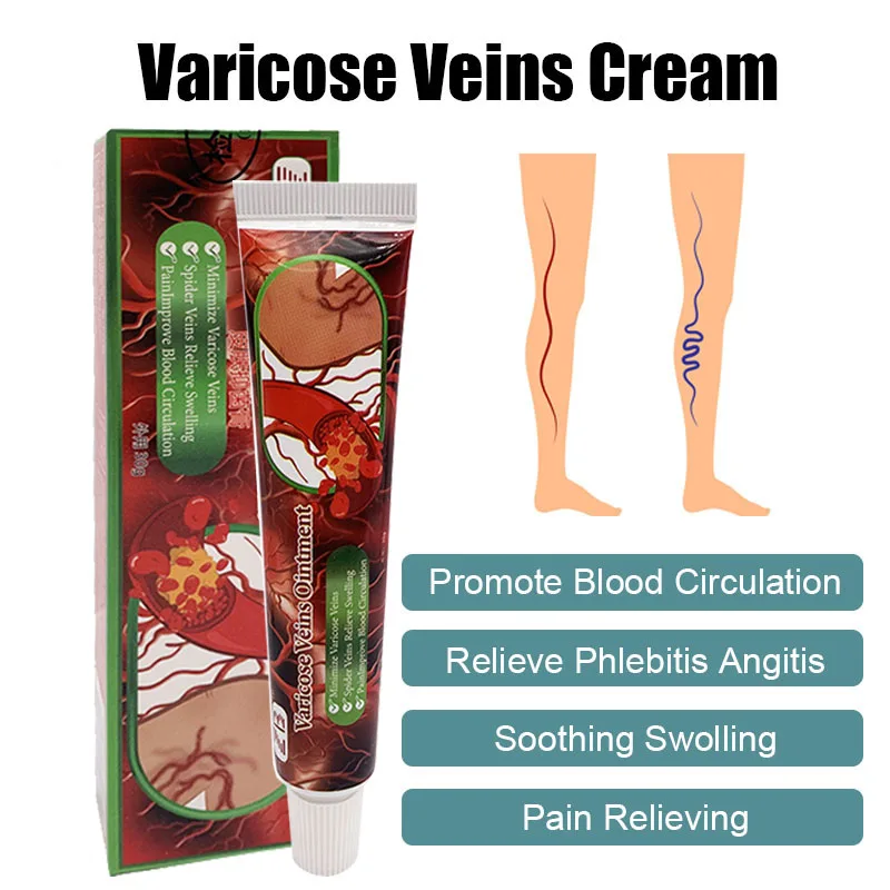 

ZB 20g Varicose Vein Ointment For Vascular Earthworm Balm Limb Soreness Swelling Ankles Pain Cream Blue Tendon Bulge Herbal