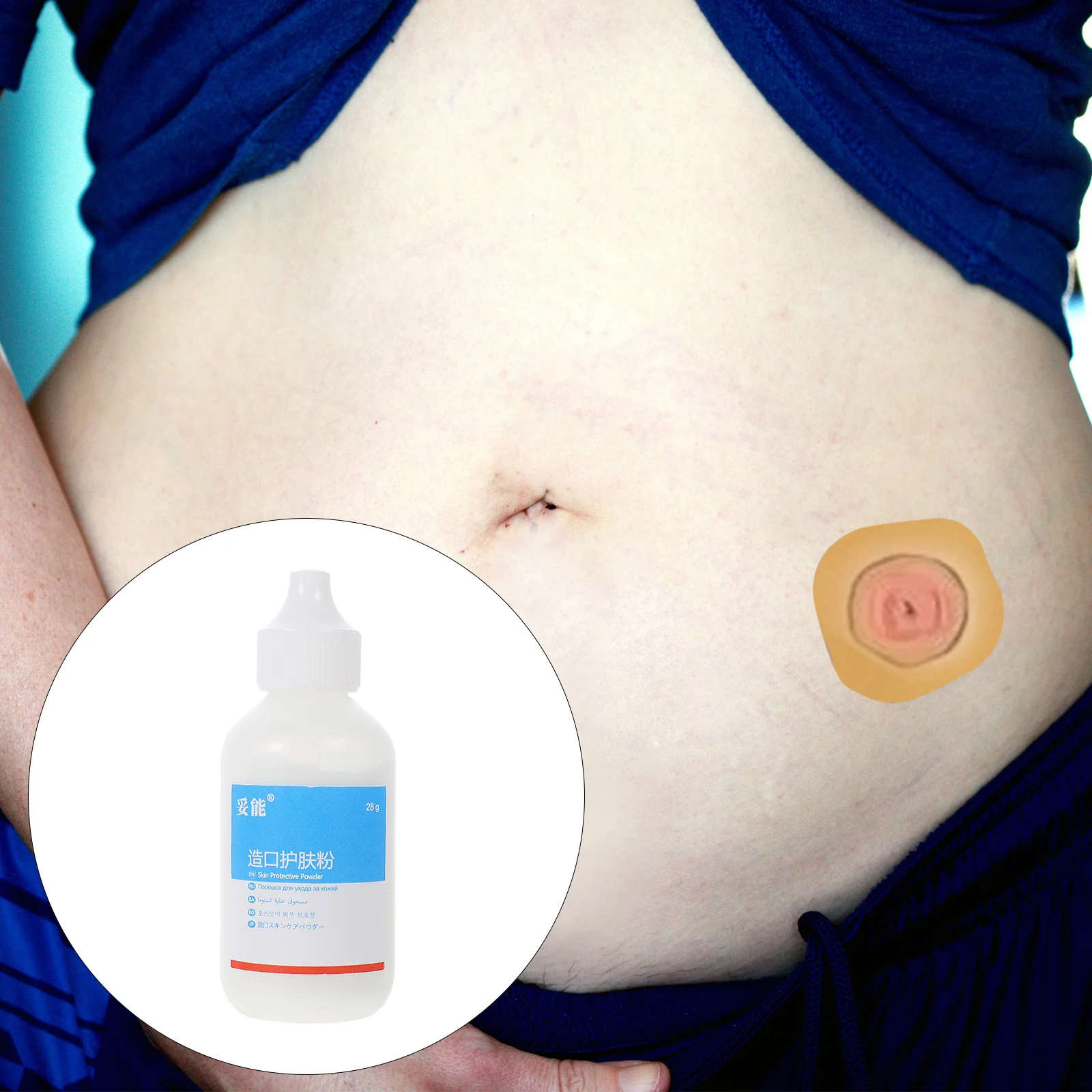 1BoxOstomyCarePowderOstomyCareToolOstomySkinProtectantStoma