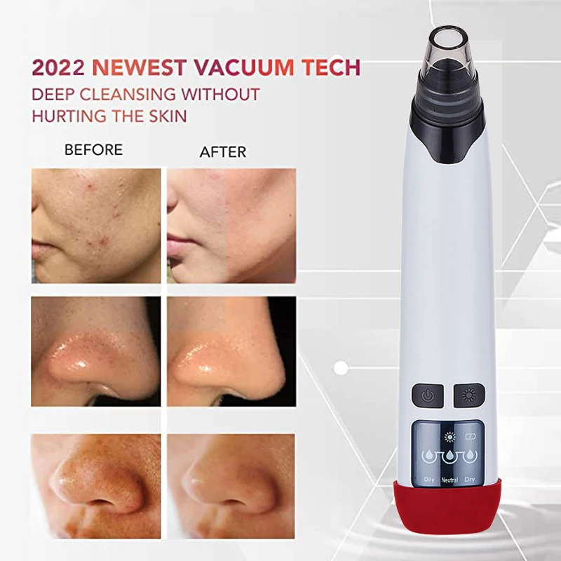 1489 Set Pore Cleaner Blackhead Acne Treatment Vacuum Extractor Electronic Facial Whitehead & Blackhead Remover for Face 5