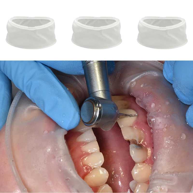 5/10/20Pcs Dental O Shape Mouth Opener Cheek Retractors Orthodontic Oral Lip Cheek Retractor Expander Teeth Whitening Dentistry 5
