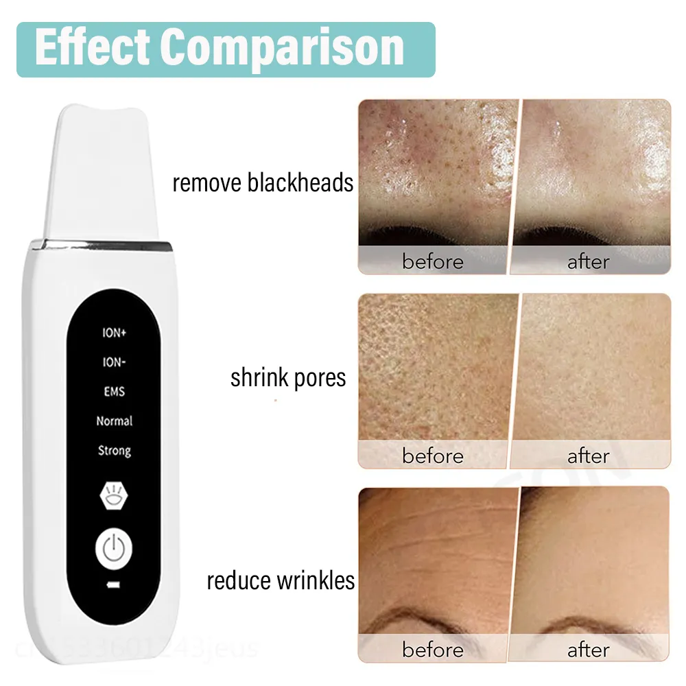 S2c4694f83fea4eeca13785d0a3b17aabm Ultrasonic Skin Scrubber Peeling Blackhead Remover Deep Face Cleaning Ultrasonic Ion Ance Pore Cleaner Facial Shovel Cleanser