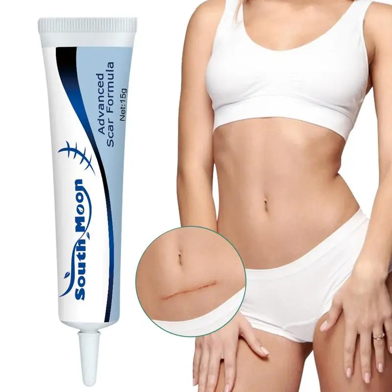 

Scar Removal Cream Old Scar Cream Effective Repair New Scars Surgical Scars Stretch Marks Acne Pits Acne Marks Burn Scars