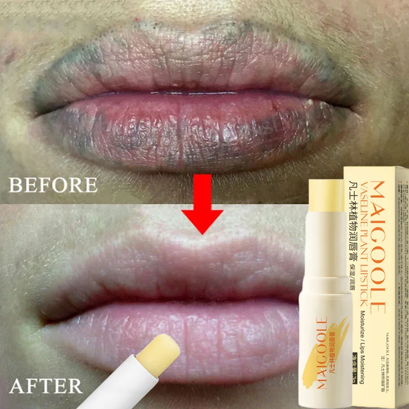 Fast Lightening Pink Mouth Lips Serum Bleaching Permanent Pinkish Moisturizing Lighten Dark Lip Balm Gloss Lipstick Lip Mask 3