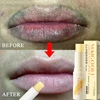 Fast Lightening Pink Mouth Lips Serum Bleaching Permanent Pinkish Moisturizing Lighten Dark Lip Balm Gloss Lipstick Lip Mask 3