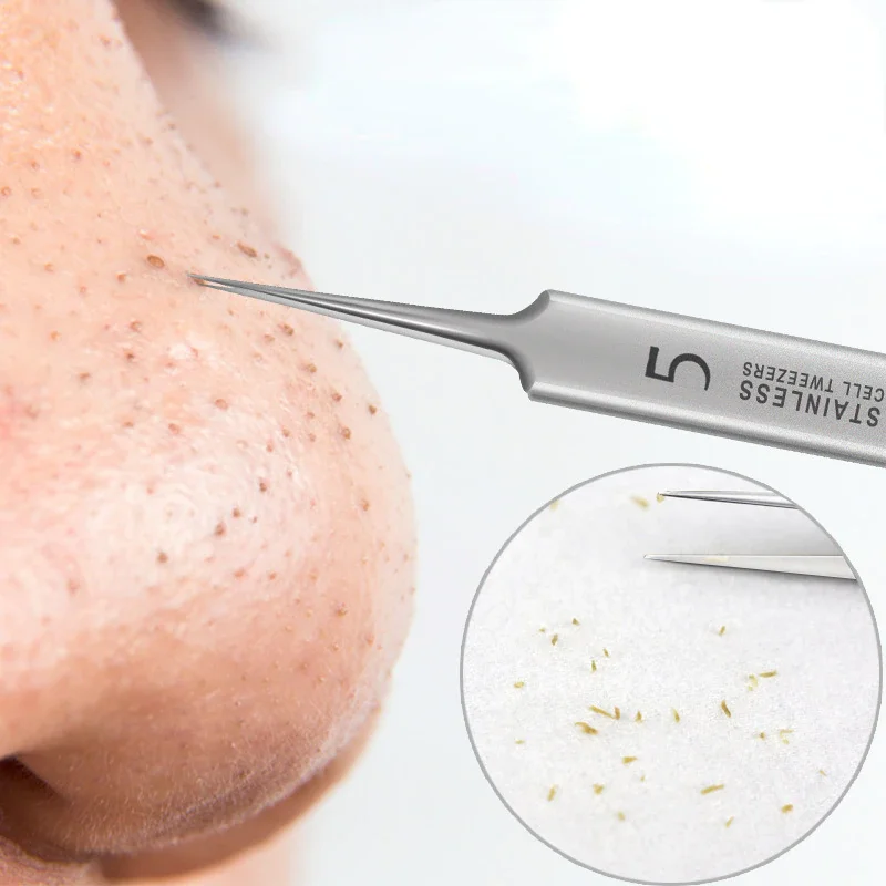 Ultra-Fine No. 5 Cell Pimples Blackhead Clip Tweezers Beauty Face Health Salon Special Blackhead Remover Acne Needle Tool