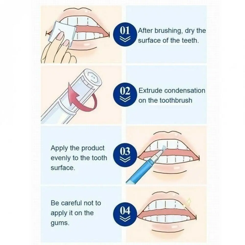 Teeth Whitening Gel Pen Extra Strong White Tooth Whitener Delicate Stain Remover Yellow Stains Oral Cleaning Color Correction
