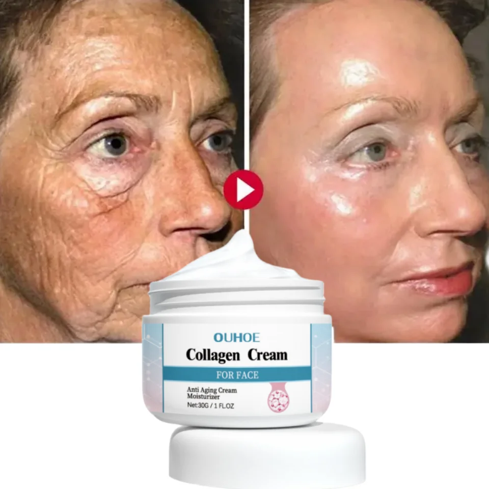 Fast Wrinkle Removal Cream Face Remove Anti-aging Nasolabial Folds Expression Lines Lighten Fine Lines Moisturizing Whitening