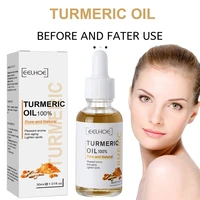 Sérum pour le visage au curcuma, rétrécit les pores, Essence réparatrice, mélanine, éclaircissant, hydratant, nourrissant, huile de cur-cumin, estompe les taches foncées, soins pour la peau 4
