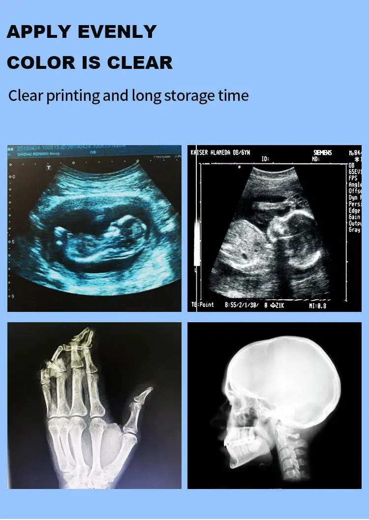  UP-890 UP-895MD UP-D895 UP-897MD UP-D897 호환 UPP-110HG 초음파 인쇄 용지, A6 사이즈, 흑백, 10 롤