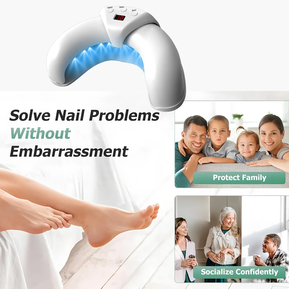 Nagellaserbehandelingsapparaat voor reparatie van teen- en vingernagelschimmel. Behandeling van onychomycose (nagelschimmel). Effectieve genezingsmachine voor het verwijderen van schimmels._voghion.com