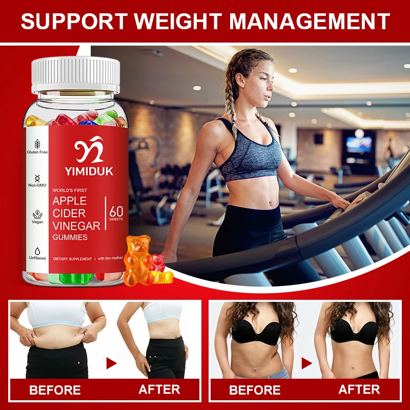Keto Slimming Gummies Natural Burning Fat Consume Fat Store Energy Malic Acid Healthy Food Grade Weight Loss Candy