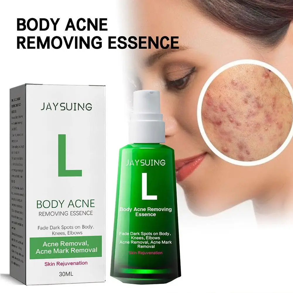 

New Acne Remover Face Serum Herbs Acne Treatment Pimple Remover Shrink Pores Oil Control Face Herb Acne Skin Care 30ml