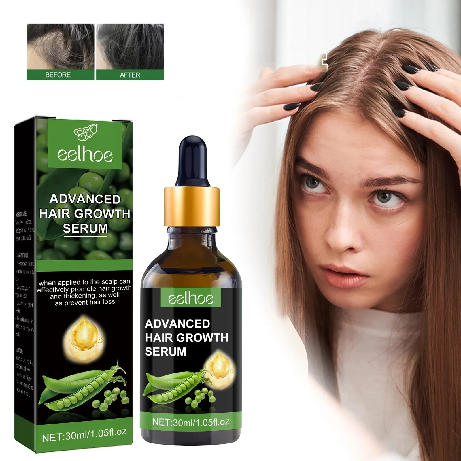 

Sdotter 30ml Eelhoe Hair Essence Hair Root Nutrition Scalp Care Strong and Tough Anti-Fall Hair-Fixing Dense Rosemary Castor Oil