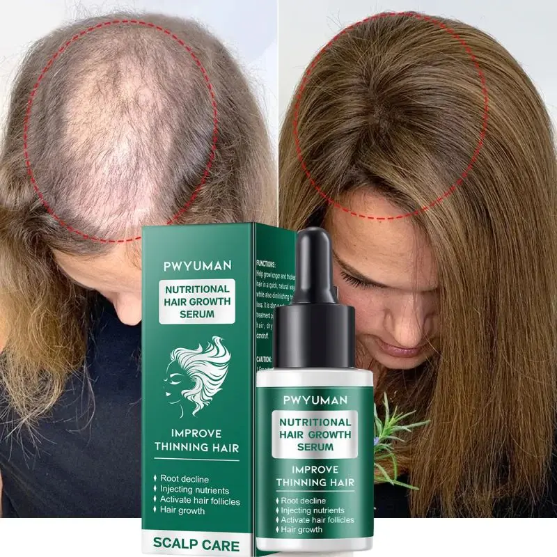 

Powerful Hair Growth Serum Oil Anti Hairs Loss repair baldness Nourish Roots Regrowth Essential Hair Care Product for Men Women