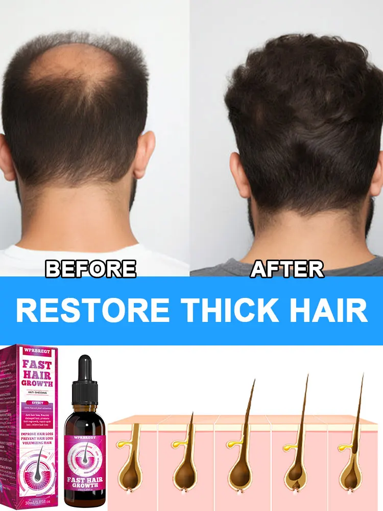 Hair Growth Oil Have More Hair Say Goodbye To Baldness