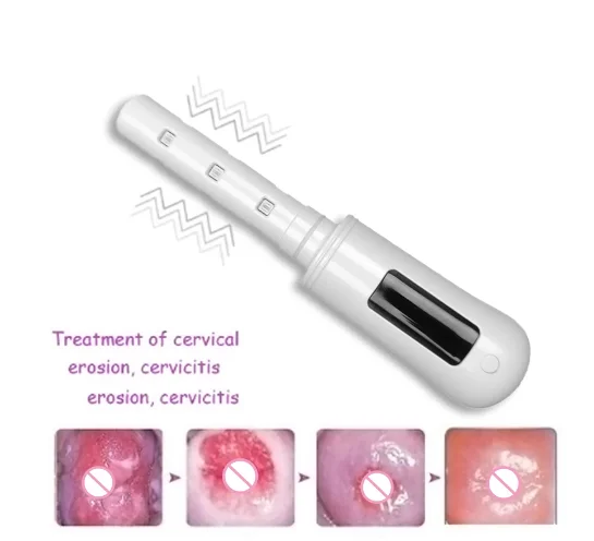 Female Women Gynecological Vaginitis Treatment Red Blue Led Lamp Therapy Device Infrared Light Clean Harmful Substance red infrared light therapy belt infrared lamp