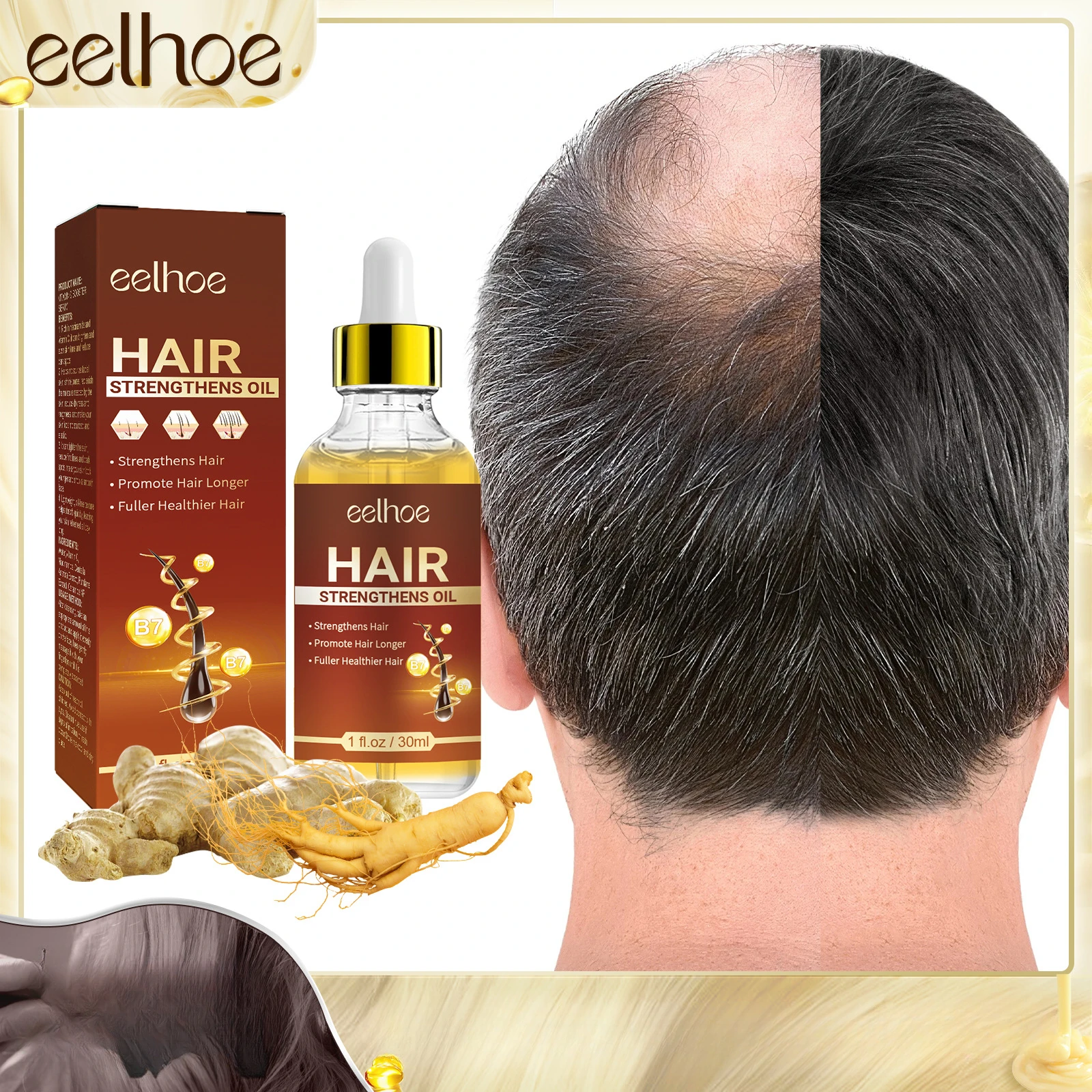 EELHOE Hair Castor Oil Essence - Nourish Your Scalp, Thicken and Strengthen Your Hair, Combat Hair Loss Ginseng and Vitamins gas guzzlers combat carnage pc