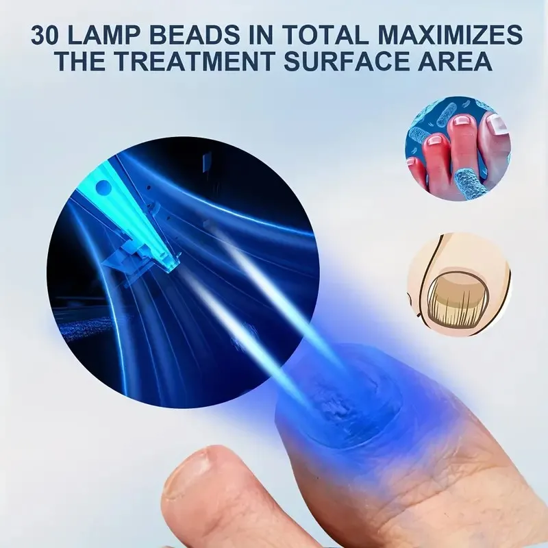 48W Nail Fungus Laser Treatment Device Digital Display 905nm Infrared Light 470nm Remove Fungal Nail Blue Therapy Anti Fungal nail fungus remover laser therapy pen